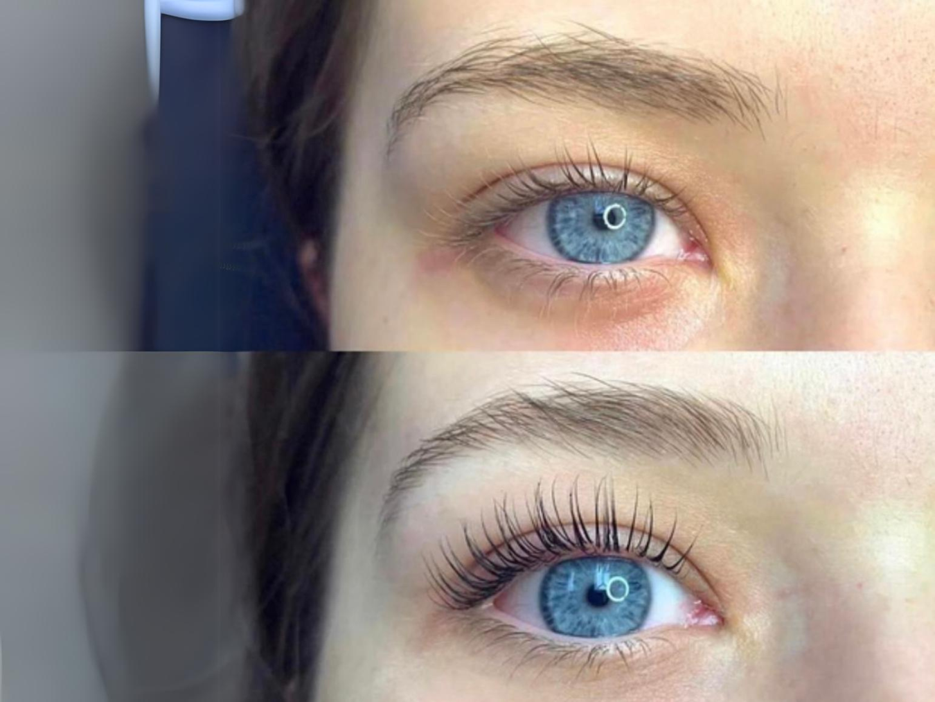 Lash Lifting vorher nachher, Lash Lifting Ergebnisse, Vorher-Nachher-Bilder Lash Lift, Wimpernlifting vorher nachher, Lash Lift Transformation, Wimpernlifting Ergebnisse, Lash Lifting vorher nachher Fotos, Effekt von Lash Lifting, Lash Lift Vorher-Nachher-Vergleich, Wimpernlifting Vorher-Nachher-Resultate, Wimpernlifting Veränderungen, Vorher nachher Lash Lifting Bilder, Unterschied Lash Lifting, Vorher nachher Wimpern Lifting, Lash Lift Ergebnisse sehen, Wimpernlifting Vorher-Nachher-Ergebnisse, Lash Lift 